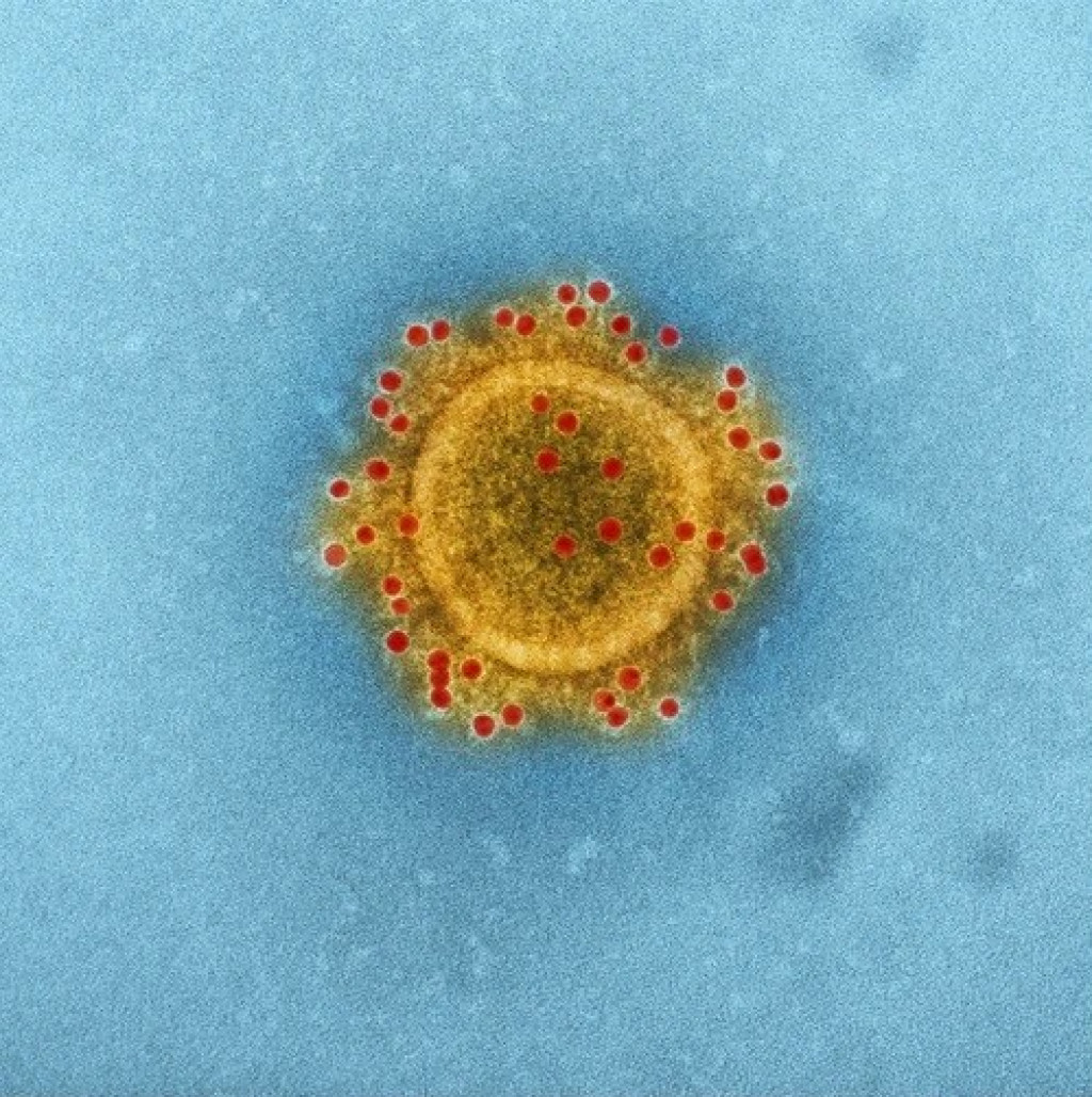1579869117-coronavirus_3.jpg